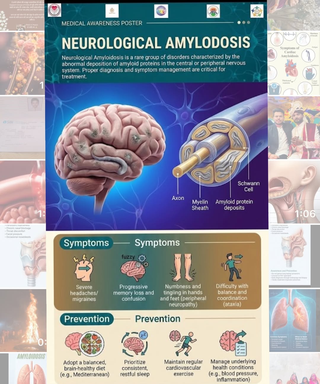 First Amyloidosis Clinic at Fortis Gurugram